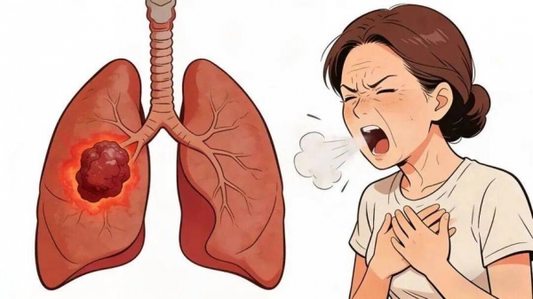 别再只防乳腺癌！为何不吸烟女性反而成肺癌“重灾区”？